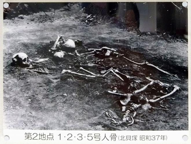 人骨